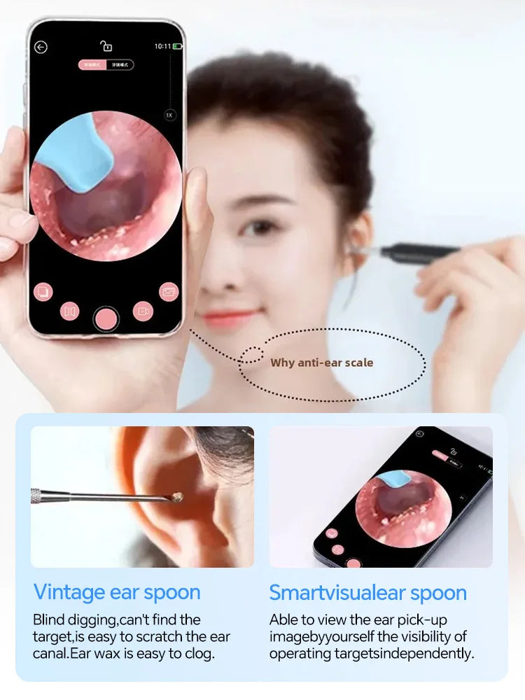 Digital Otoscope Ear Wax Cleaner with HD Camera - Tidesmit Relaxation Treatment Tidesmit
