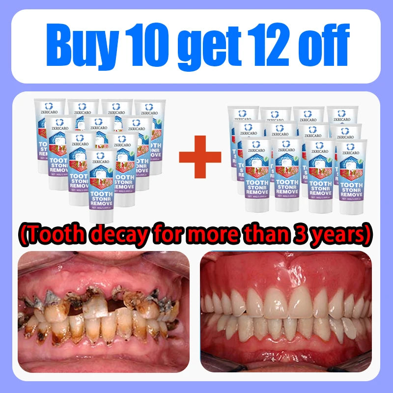 Tooth Decay Repair Treatment - Natural Oral Care Serum by Tidesmit Scrubs Treatments Buy 10 Get 12 Free Tidesmit