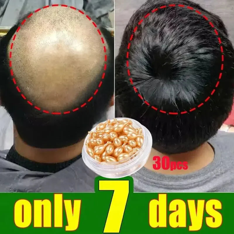 Tidesmit hair growth serum capsules for fast baldness repair, anti-hair loss scalp treatment, and regrowth for women.