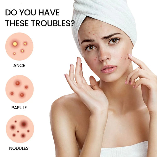 Woman with acne spots and trouble-type icons for pimple patches