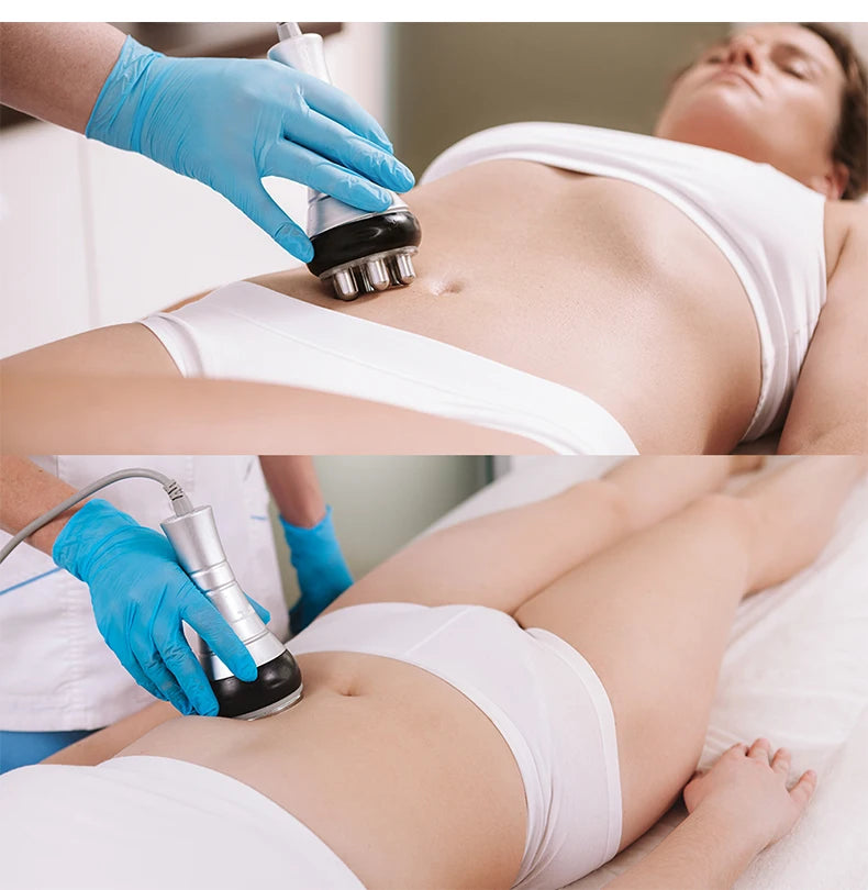 Hand in blue gloves uses a silver and black cavitation machine wand on a person's abdomen for body shaping.