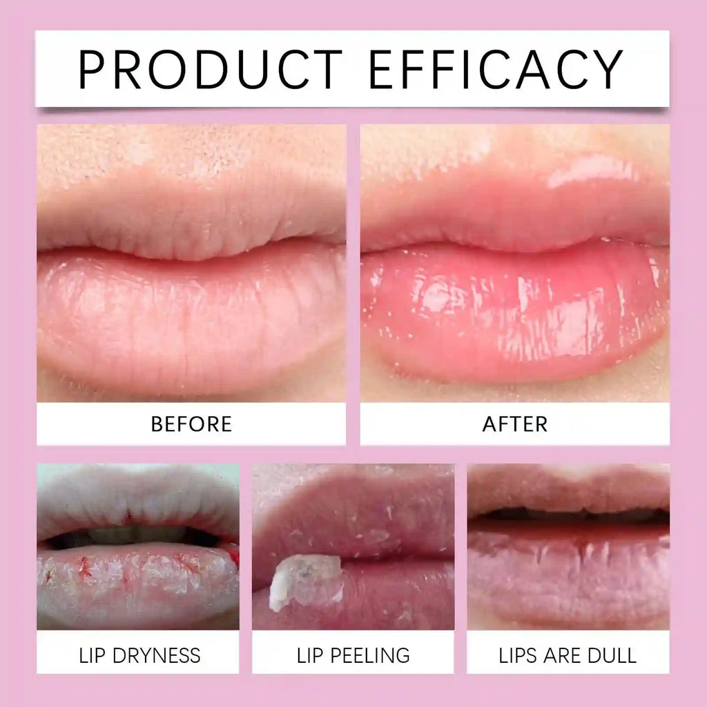 Lip Plumper Serum | Instant Hydrating Lip Treatment for Fuller Lips Lip Care Tidesmit