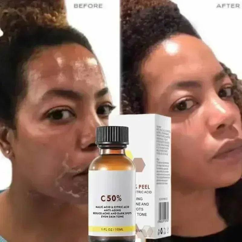Exfoliating Lip Scrub to Fade Dark Spots | Nourishing Lip Treatment Lip Care Tidesmit