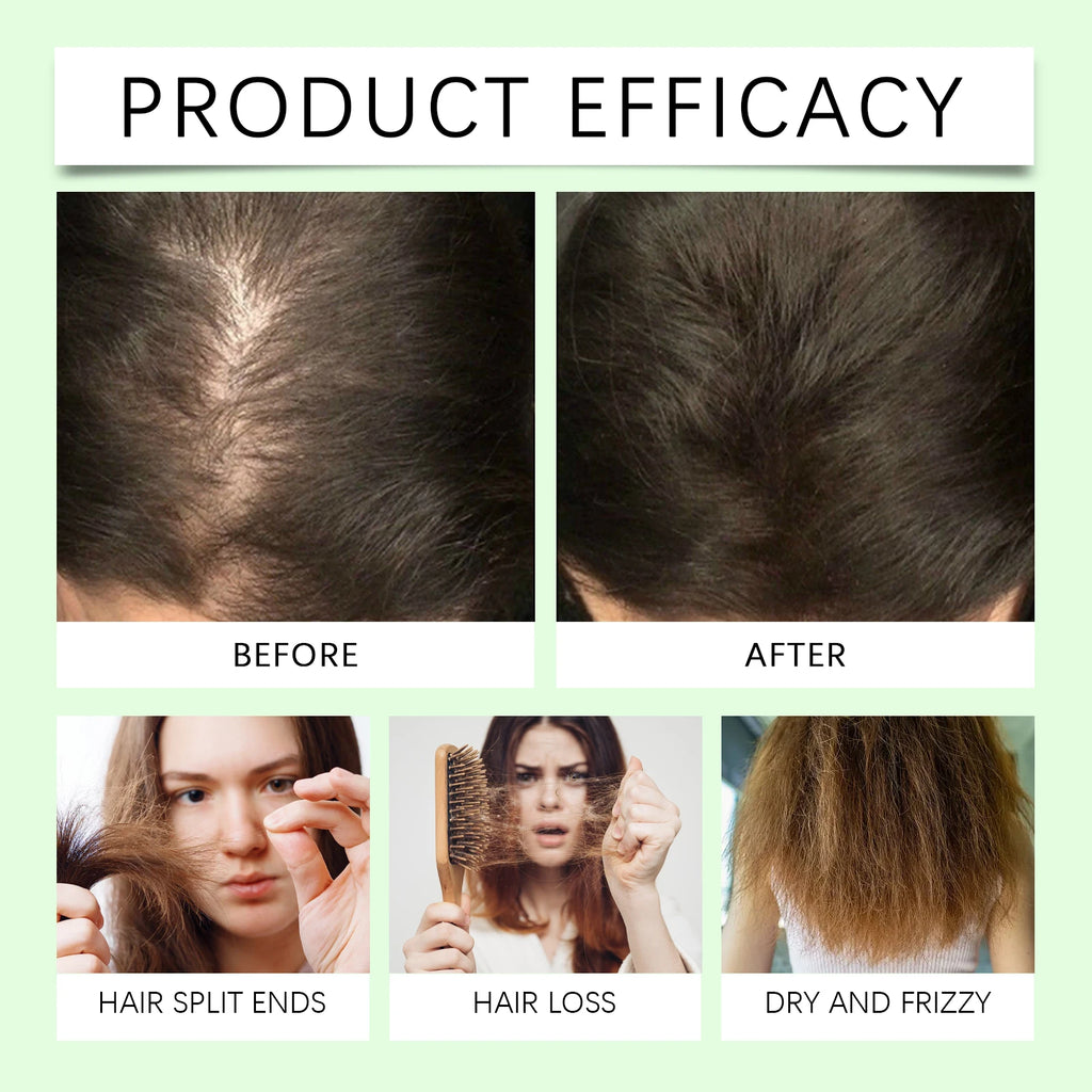 Rosemary Shampoo For Hair Thickness-Volumizing Strengthening-Hydrates Reduces Breakage-Sulfate-Free For Fuller Looking Hair