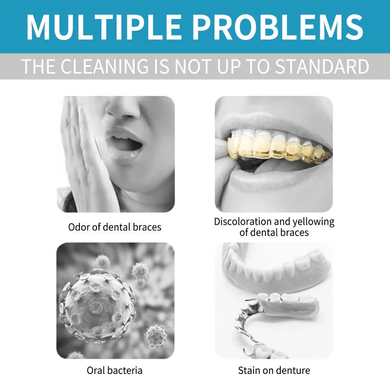 Tidesmit 30ml aligner denture cleaner foam for deep cleaning braces stains and fresh breath