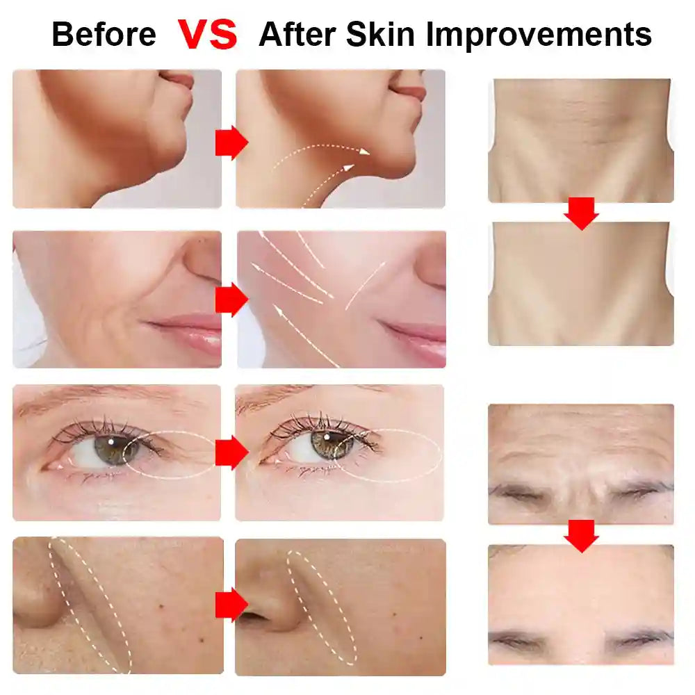 HIFU Face Lifting Machine with EMS Microcurrent & Heat Therapy Eye Massage Instrument Tidesmit