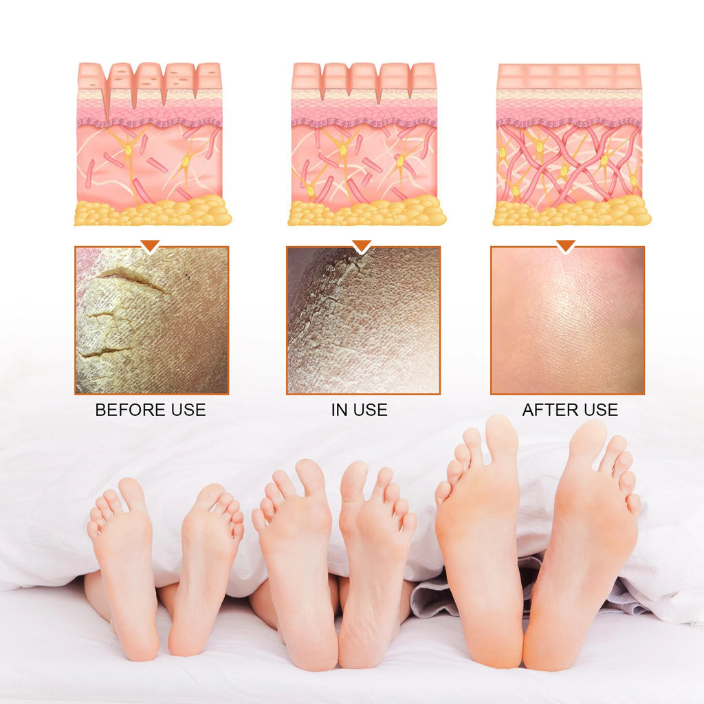 Exfoliating Foot Spray for Cracked Skin - Salon-Quality Repair Scrubs Treatments Tidesmit