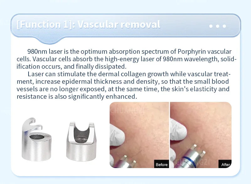 980nm Diode Laser Vascular Vein Removal Device 6-in-1 Therapy Relaxation Treatment Tidesmit