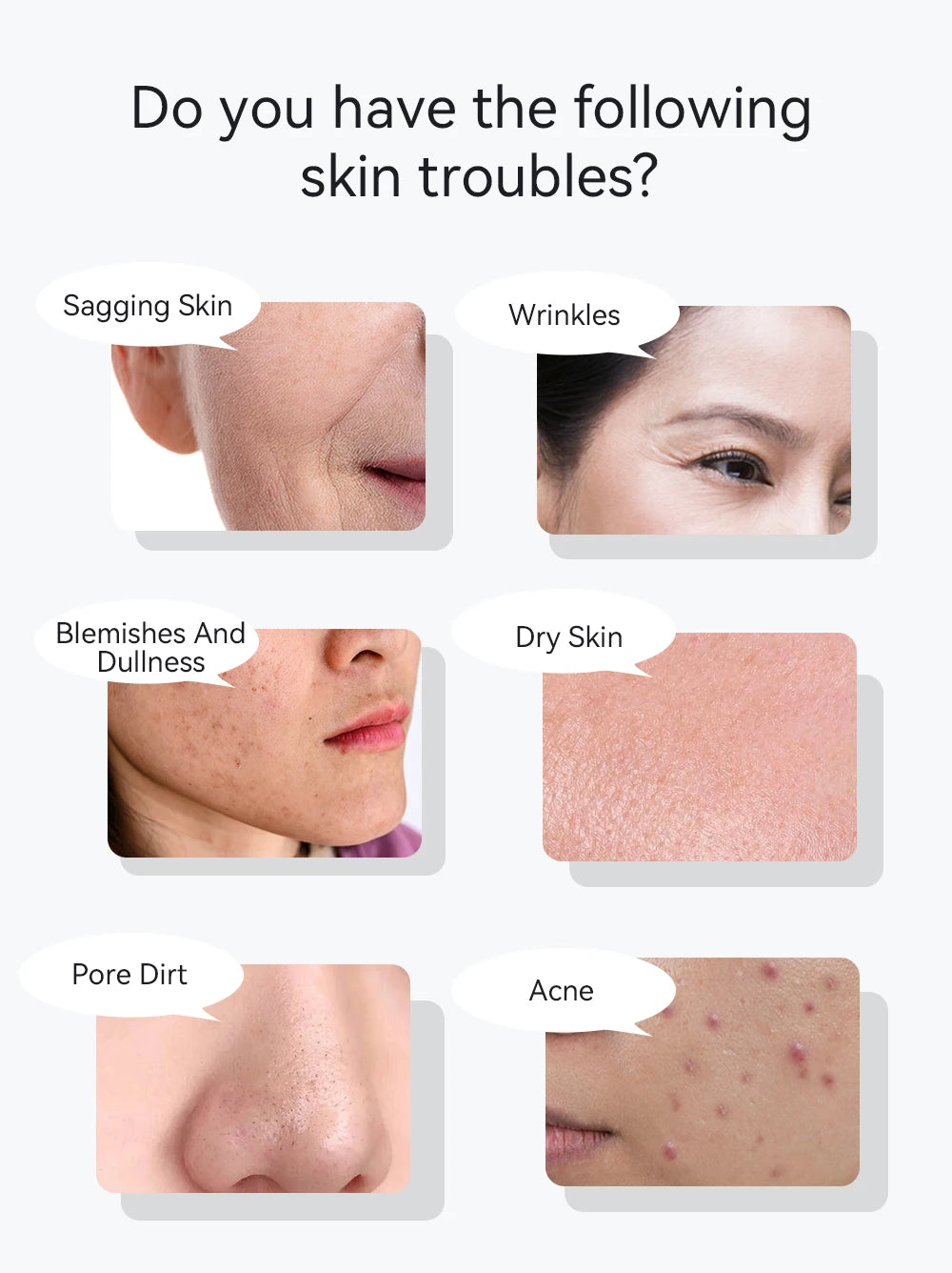 ANLAN EMS facial massager addresses skin concerns like sagging, wrinkles, dullness, dry skin, pore dirt, and acne.