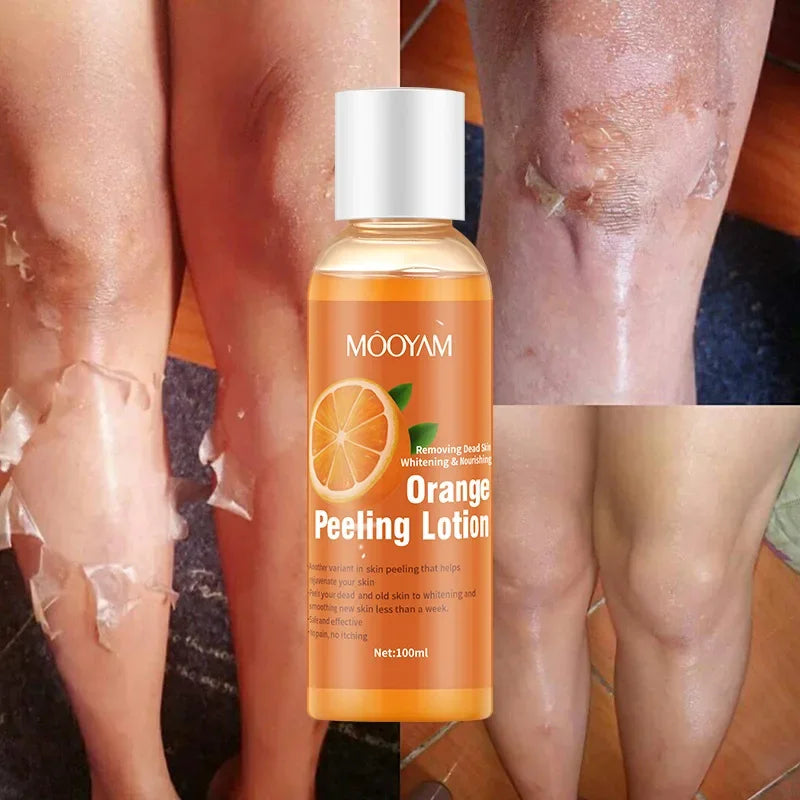 Orange Peeling Lotion for Gentle Body Exfoliation - Natural AHA Formula Scrubs Treatments Default Title Tidesmit