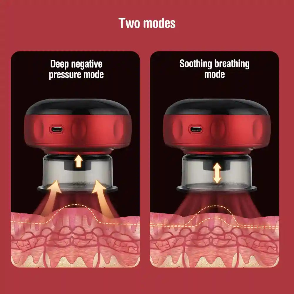 Electric Cupping Massager: 12-Gear Heat Therapy for Muscle Relief Massage Roller Tidesmit