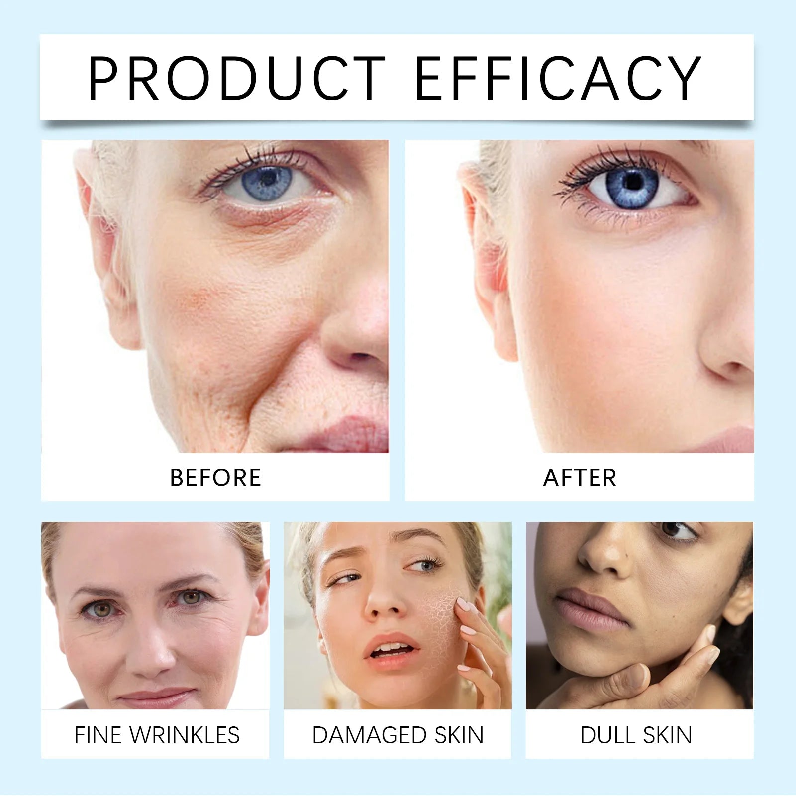 Skin efficacy before-and-after skincare results panel with face close-up comparisons