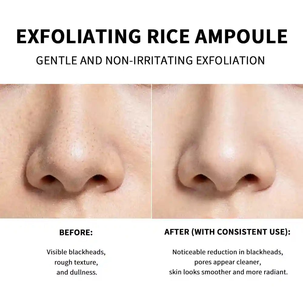 Rice Exfoliating Face Scrub for Clear Skin | Blackhead Remover | Tidesmit Scrubs Treatments Tidesmit