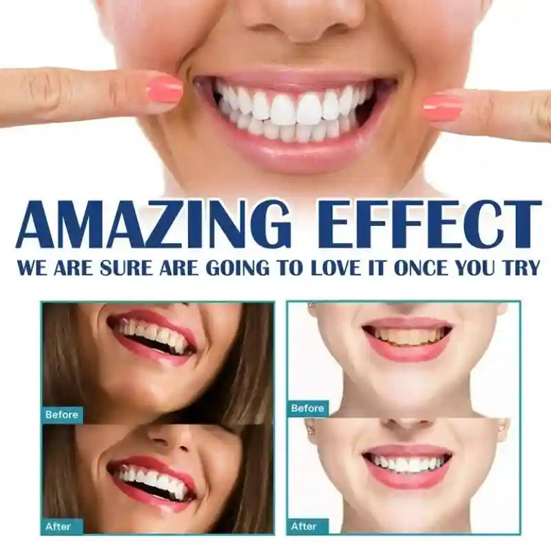 Tidesmit teeth whitening serum gel removing yellow smoke stains and plaque for brighter teeth and fresh breath