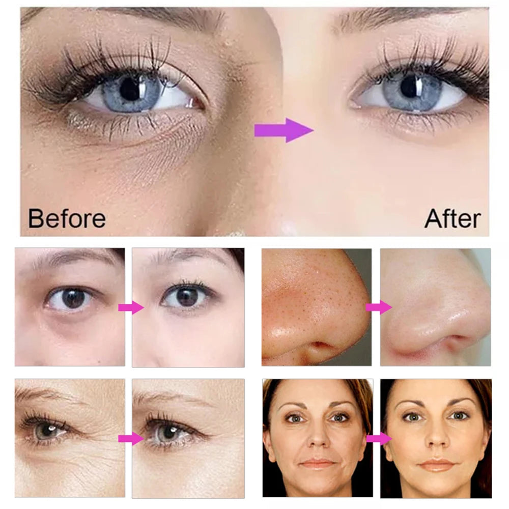 PMU Machine for Skin Tightening and Permanent Makeup - Tidesmit Pro Series Permanent Makeup Machines Tidesmit
