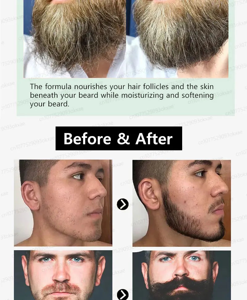 Beard Growth Liquid for Thicker Fuller Hair - Tidesmit Natural Formula Scrubs Treatments Tidesmit