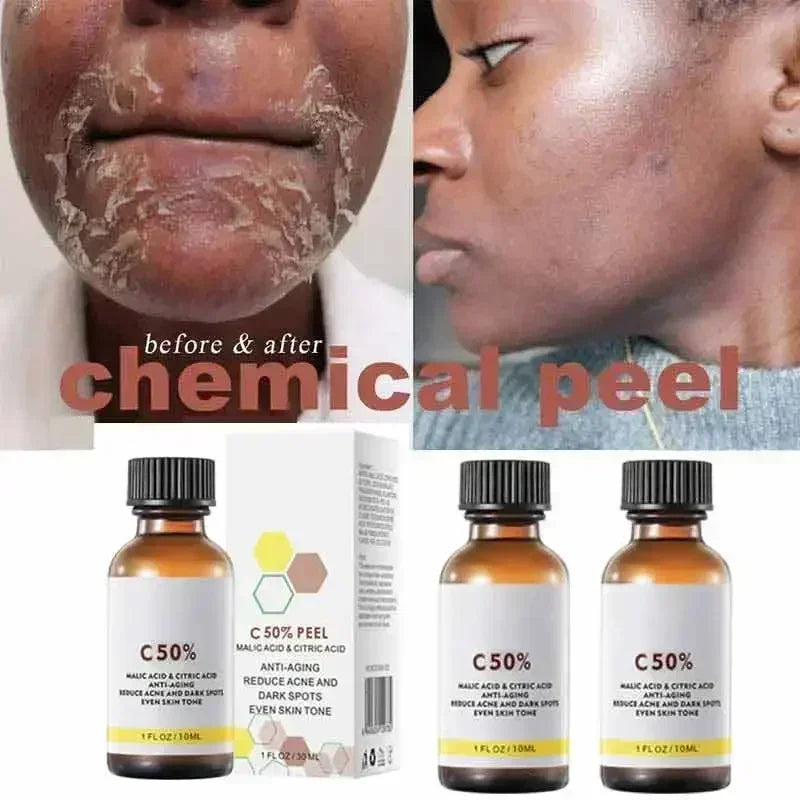 Exfoliating Lip Scrub to Fade Dark Spots | Nourishing Lip Treatment Lip Care Tidesmit