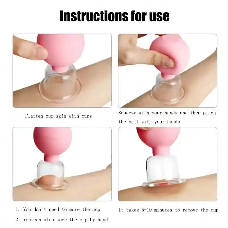 Silicone cupping therapy set with clear glass cups and pink squeeze bulbs, demonstrating suction application on skin.