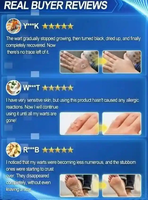 Before and after results of skin wart removal treatment showing clear skin recovery in real customer reviews.