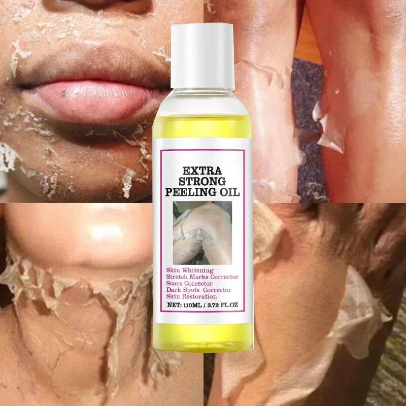 Yellow Peeling Oil for Dark Skin - Salon-Quality 100ml Exfoliating Treatment Scrubs Treatments Tidesmit
