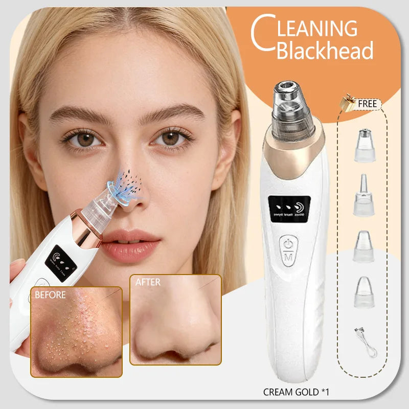 White and gold electric blackhead remover vacuum for face, showing before and after nose pore cleaning with attachments.