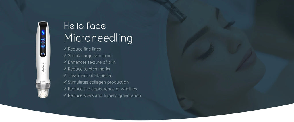 White, handheld, electric microneedling pen for facial skin rejuvenation and texture improvement.