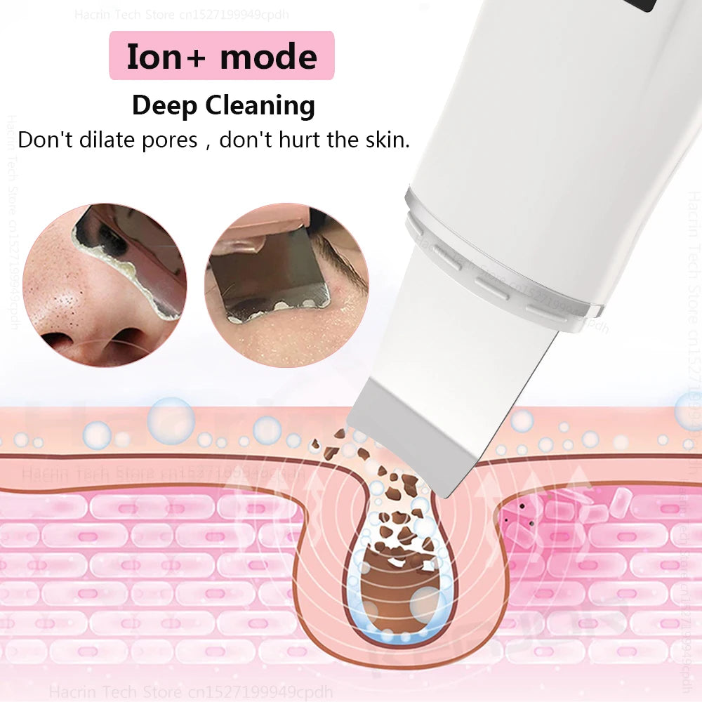 Ultrasonic Face Scrubber - Deep Pore Cleaning & Blackhead Removal Device Scrubs Treatments Tidesmit