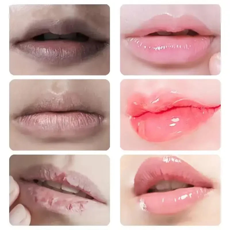 Dark Lip Lightening Balm – Exfoliating Lip Care Treatment by Tidesmit Lip Care Tidesmit