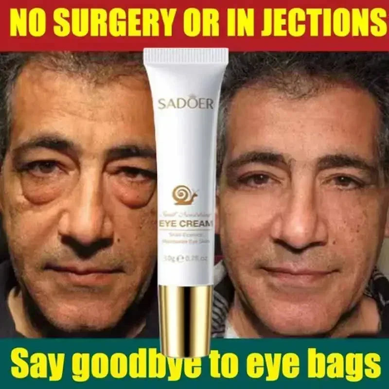 Instant Anti Aging Eye Cream for Dark Circles and Puffiness | Tidesmit Relaxation Treatment Tidesmit