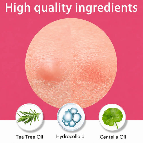 Hydrocolloid acne patch ingredients graphic with tea tree oil, hydrocolloid, centella oil icons