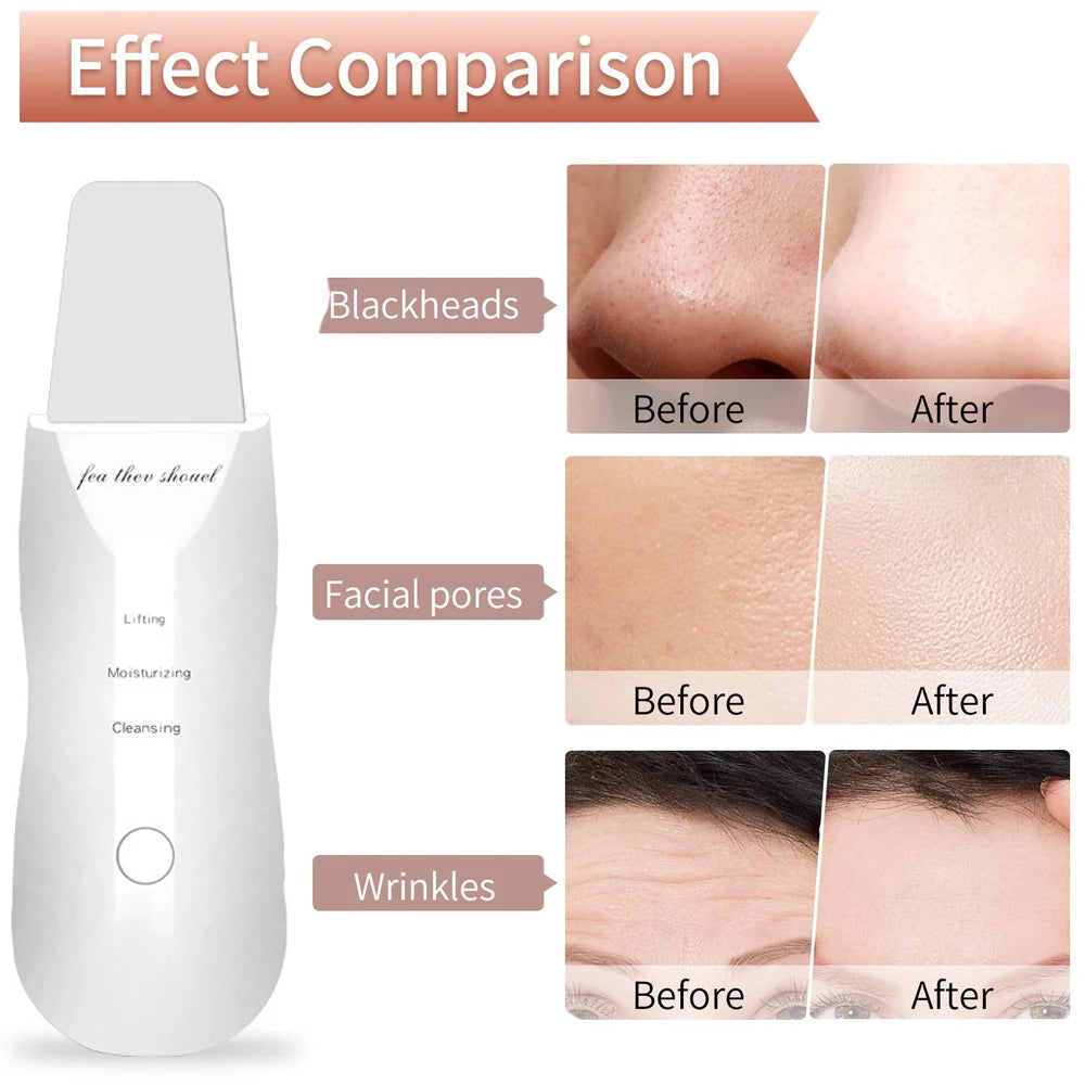 Electric Facial Spatula Skin Scrubber - Deep Pore Cleansing Tool Scrubs Treatments Tidesmit