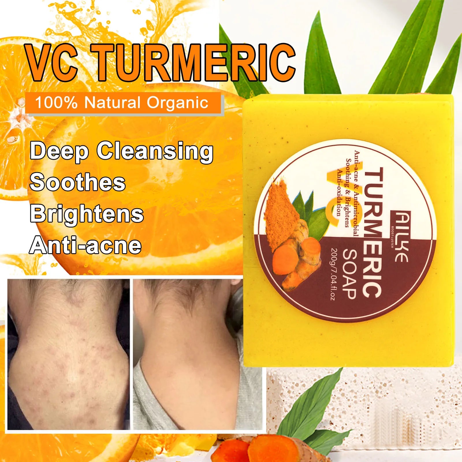 AILKE Natural Turmeric Soap for Face & Body, Whitening, Clean Stains, Even Skin Tone, Remove Acne, Age Spot, Black Spot, 200g