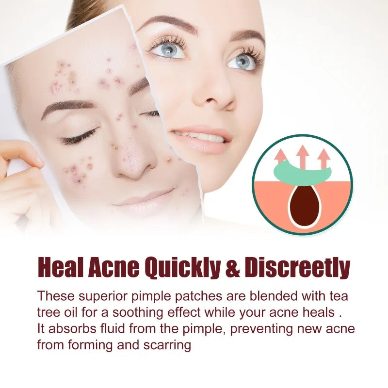 400pcs Star Acne Patches Invisible Pimple Cover for Face Oil Control Spot Treatment Cute Sticker for Covering Zits and Blemishes