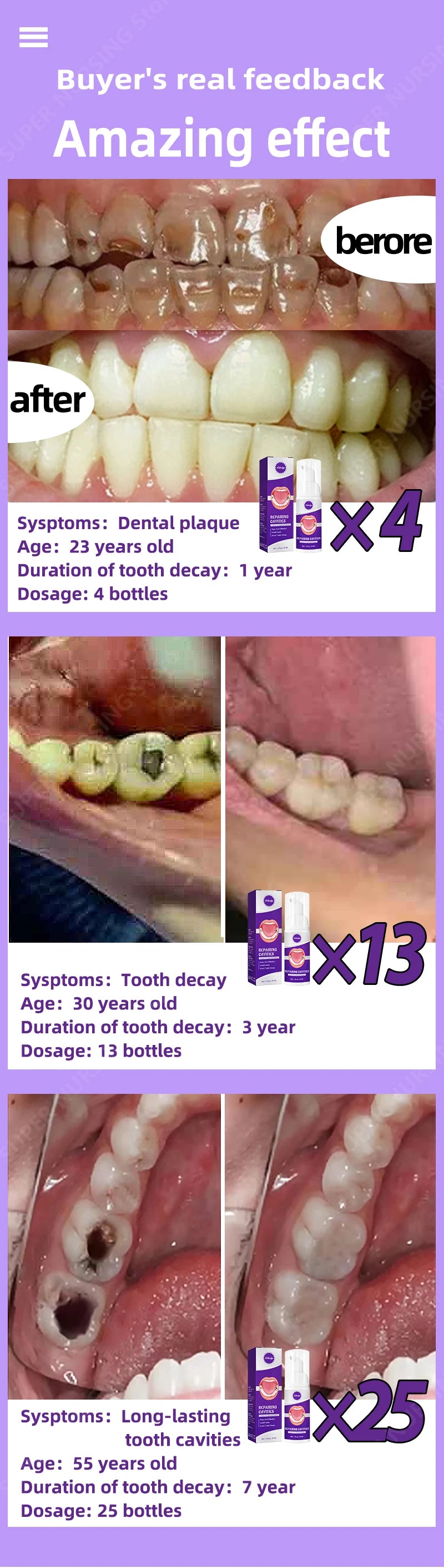 Tidesmit anti-caries teeth whitening treatment for healing cavities and enamel repair