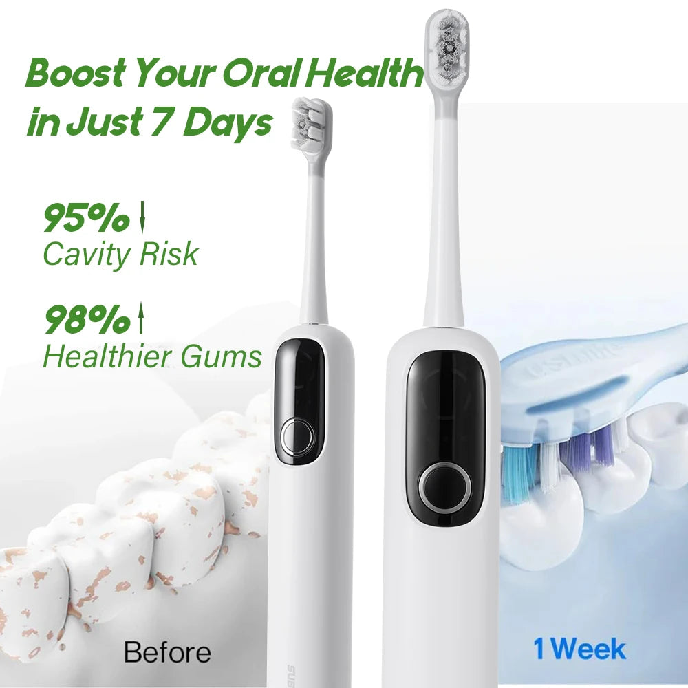 SUBORT S1 Sonic Oscillating Electric Toothbrush, 60° Swing, UV Sterilization Box, Copper-Free Brush Head, 220 Days Battery Life