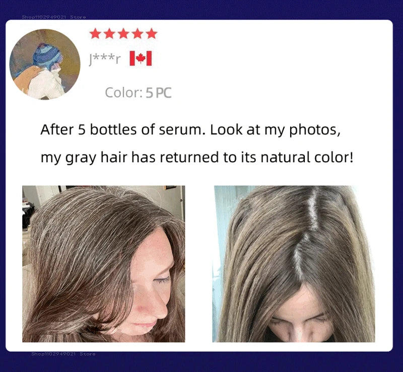 Anti Gray Hair Serum – Natural Scalp Nourishing Darkening Care Lip Care Tidesmit