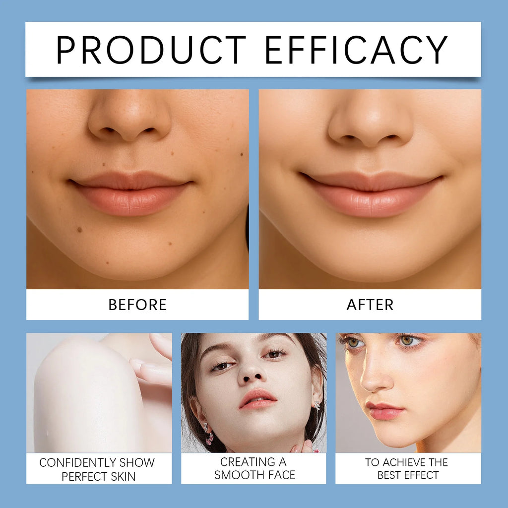 Before and after results of a laser plasma pen for removing skin tags, dark spots, freckles, and moles for face.