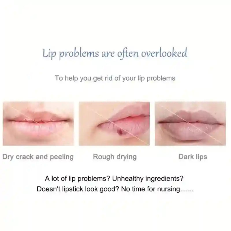 Dark Lip Lightening Balm: Moisturizing Treatment by Tidesmit Lip Care Tidesmit