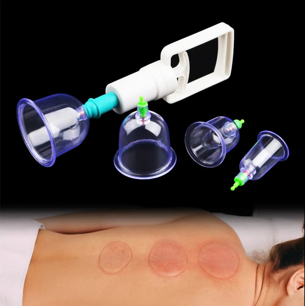 Vacuum Cupping Set 6-Piece Body Massage Kit for Back Pain Relief Body Shaping Massage Equipment Tidesmit