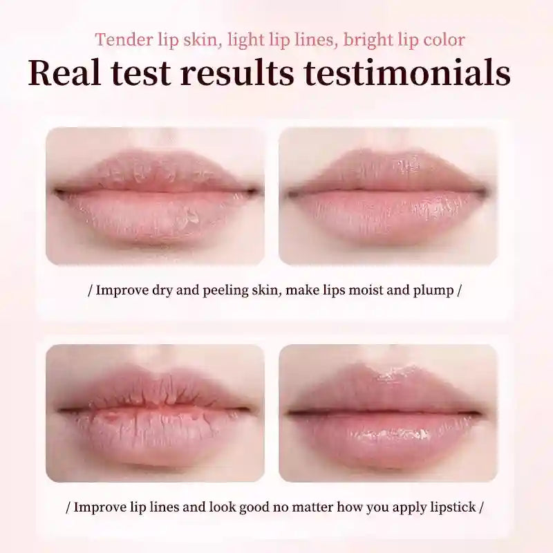 Lip Treatment for Dark Pigmentation - Moisturizing Exfoliator (1-5 Pcs) Lip Care Tidesmit