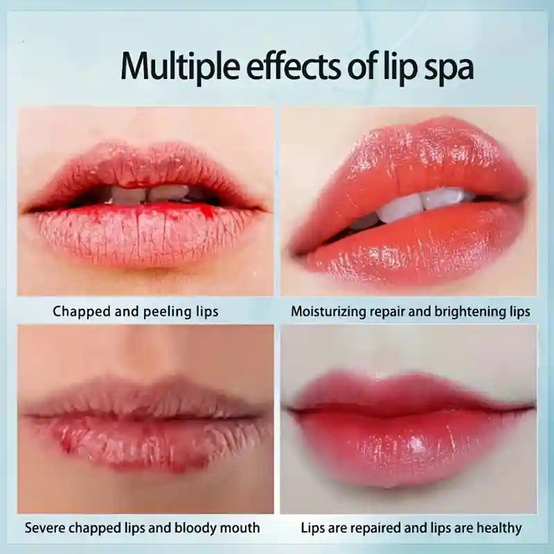 Collagen Lip Masks - 6pc Hydrating Gel Treatment for Soft Plump Lips Lip Care Tidesmit