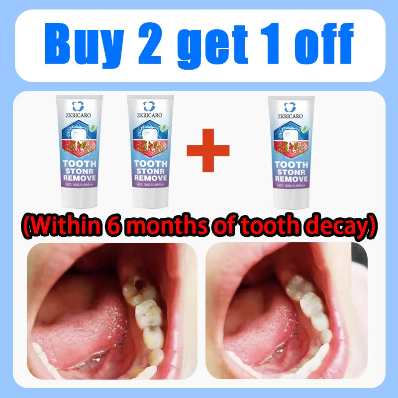 Tooth Decay Repair Treatment | Natural Deep Cleaning & Restorative Formula Scrubs Treatments Buy 2 Get 1 Free Tidesmit