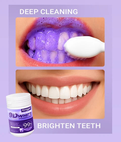 Tidesmit 9.9% purple hydroxyapatite teeth whitening powder for deep cleaning and fresh breath dental care