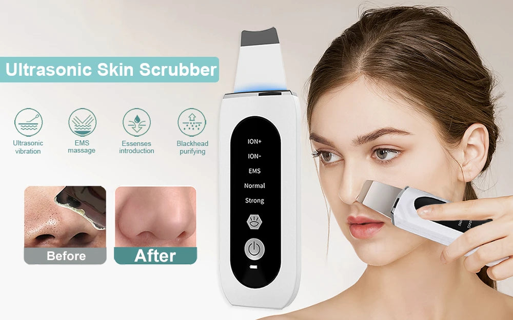 Ultrasonic Skin Scrubber | Professional Facial Cleansing Tool Scrubs Treatments Tidesmit