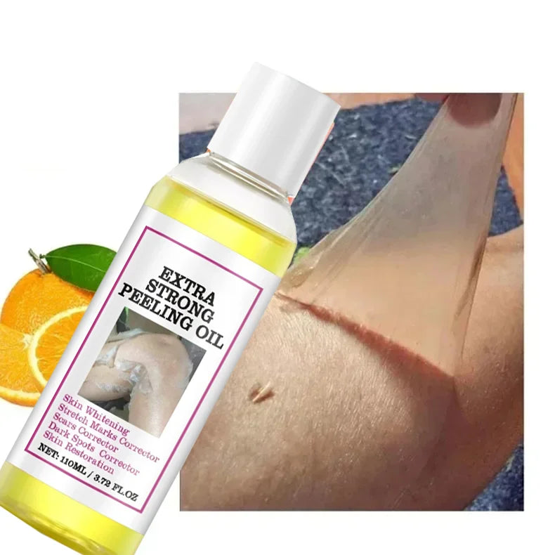 Yellow Peeling Oil for Dark Skin - Salon-Quality 100ml Exfoliating Treatment Scrubs Treatments Tidesmit