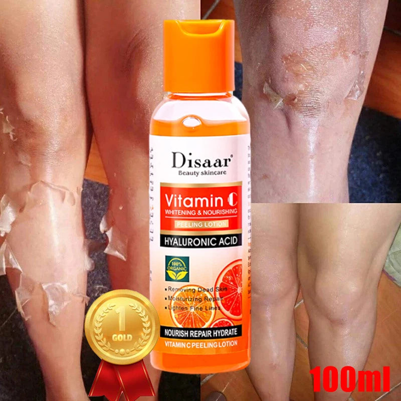 Yellow Peeling Oil for Dark Skin - 100ml Professional Exfoliating Treatment Scrubs Treatments Tidesmit