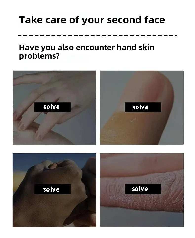 Hand cream for removing wrinkles on finger joints, removing hand wrinkles, and reducing joint roughness and blackness