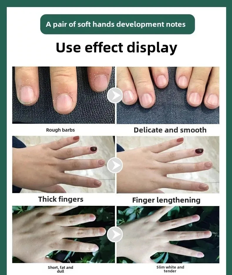 Hand cream for removing wrinkles on finger joints, removing hand wrinkles, and reducing joint roughness and blackness