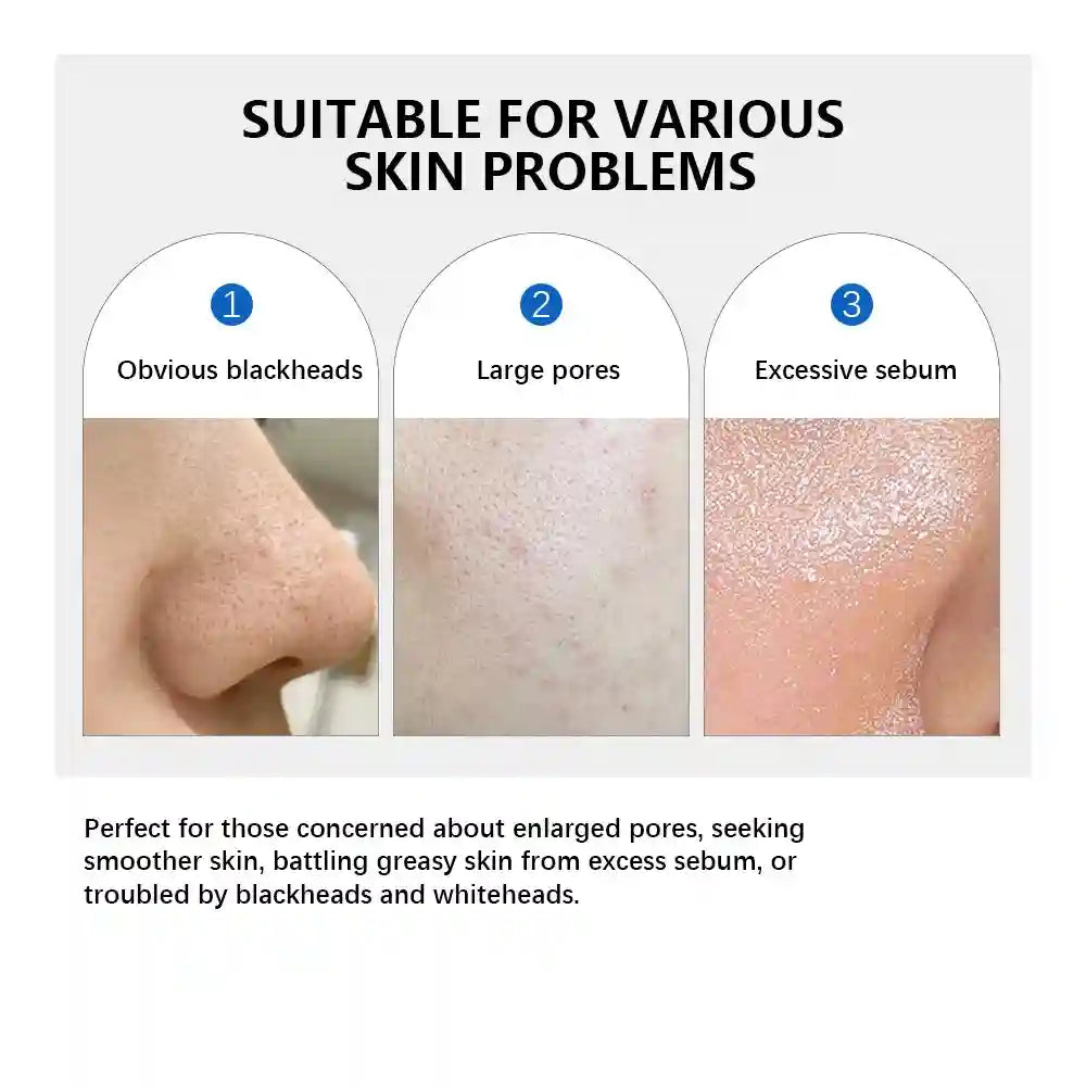 Zero Pore Toner Pad | Exfoliating Facial Skin Care – 70 Count Scrubs Treatments Tidesmit