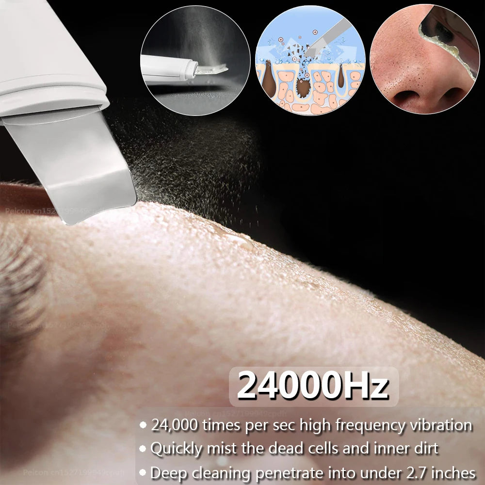 Ultrasonic Skin Scrubber Facial Cleanser - White Professional Care Scrubs Treatments Tidesmit